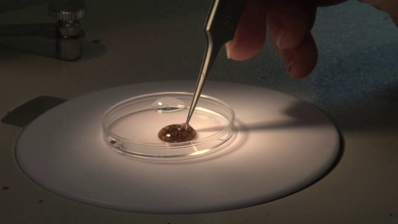 Fat Flies Reveal Obesity Clues